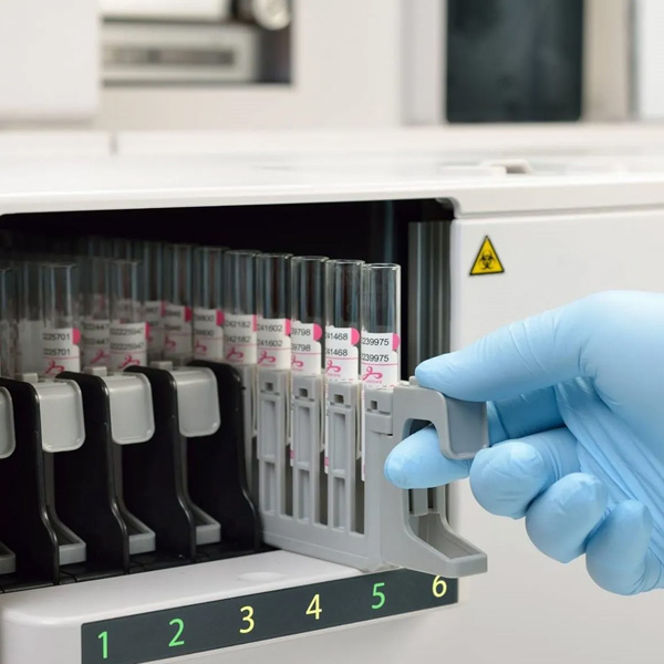 Biomarker discovery
