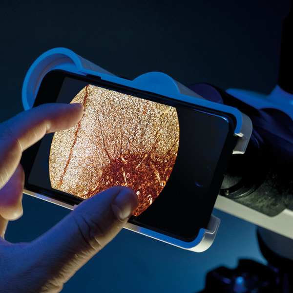 Live-Cell Imaging
