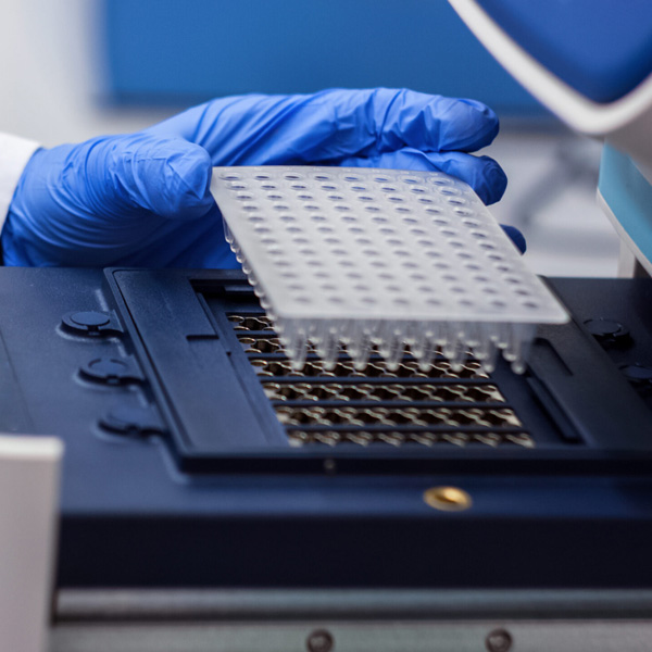 PCR Analysis
