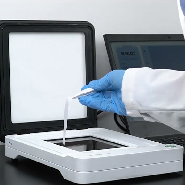 Western Blot Imaging